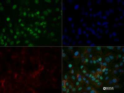 Immunocytochemistry/ Immunofluorescence: HNF-3 alpha/FoxA1 Antibody (3B11NB) - BSA Free [NBP2-45269]