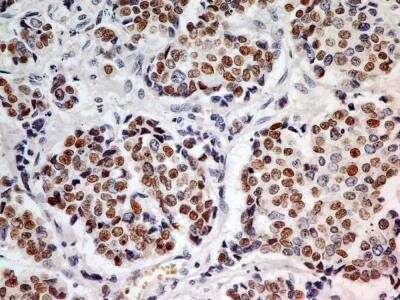 Immunohistochemistry-Paraffin: HNF-3 alpha/FoxA1 Antibody (3B11NB) - BSA Free [NBP2-45269]