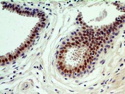 Immunohistochemistry-Paraffin: HNF-3 alpha/FoxA1 Antibody (3B11NB) - BSA Free [NBP2-45269]
