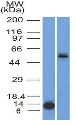 Western Blot: HNF-3 alpha/FoxA1 Antibody (3B11NB)BSA Free [NBP2-45269]
