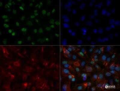 Immunocytochemistry/ Immunofluorescence: HNF-3 alpha/FoxA1 Antibody (3B3NB) - Azide and BSA Free [NBP2-45355]