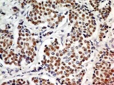 Immunohistochemistry: HNF-3 alpha/FoxA1 Antibody (3B3NB) - Azide and BSA Free [NBP2-45355]