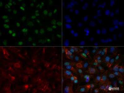 Immunocytochemistry/ Immunofluorescence: HNF-3 alpha/FoxA1 Antibody (3B3NB) - BSA Free [NBP2-45354]