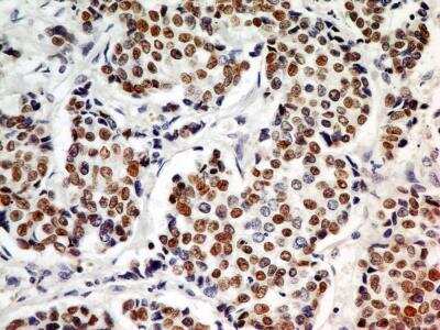 Immunohistochemistry-Paraffin: HNF-3 alpha/FoxA1 Antibody (3B3NB) - BSA Free [NBP2-45354]