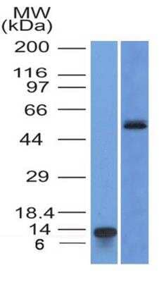 Western Blot: HNF-3 alpha/FoxA1 Antibody (3B3NB)BSA Free [NBP2-45354]