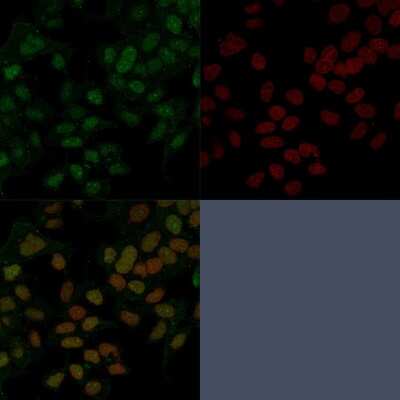 Immunocytochemistry/ Immunofluorescence: HNF-3 alpha/FoxA1 Antibody (FOXA1/1241) - Azide and BSA Free [NBP2-54357]