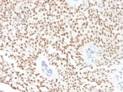 Immunohistochemistry-Paraffin: HNF-3 alpha/FoxA1 Antibody (FOXA1/1241) - Azide and BSA Free [NBP2-54357]