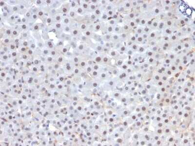 Immunohistochemistry-Paraffin: HNF-3 alpha/FoxA1 Antibody (FOXA1/1241) - Azide and BSA Free [NBP2-54357]