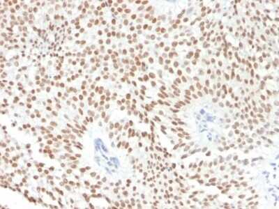 Immunohistochemistry-Paraffin: HNF-3 alpha/FoxA1 Antibody (FOXA1/1241) [NBP2-53211]