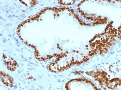 Immunohistochemistry-Paraffin: HNF-3 alpha/FoxA1 Antibody (FOXA1/1241) [NBP2-53211]