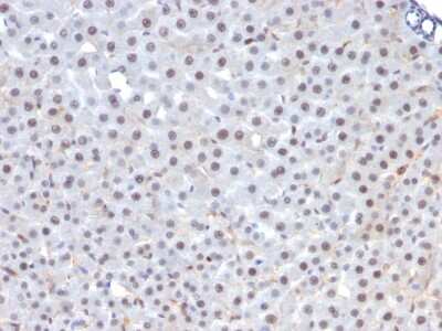 Immunohistochemistry-Paraffin: HNF-3 alpha/FoxA1 Antibody (FOXA1/1241) [NBP2-53211]