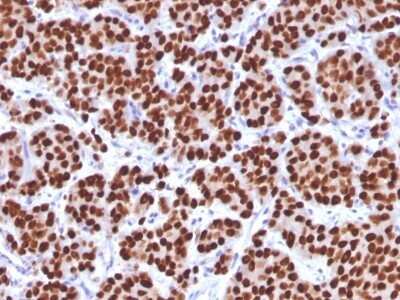 Immunohistochemistry-Paraffin: HNF-3 alpha/FoxA1 Antibody (FOXA1/1512) - Azide and BSA Free [NBP2-54576]