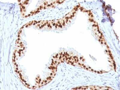 Immunohistochemistry-Paraffin: HNF-3 alpha/FoxA1 Antibody (FOXA1/1512) - Azide and BSA Free [NBP2-54576]