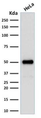 Western Blot: HNF-3 alpha/FoxA1 Antibody (FOXA1/1512) [NBP2-53337]