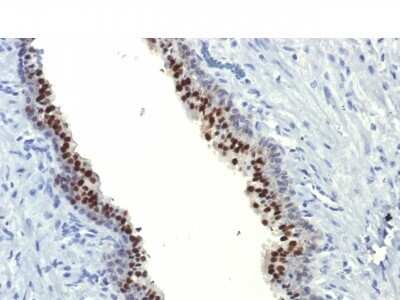 Immunohistochemistry-Paraffin: HNF-3 alpha/FoxA1 Antibody (FOXA1/1514) - Azide and BSA Free [NBP2-54575]