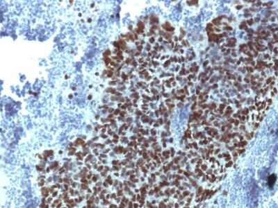 Immunohistochemistry-Paraffin: HNF-3 alpha/FoxA1 Antibody (FOXA1/1514) - Azide and BSA Free [NBP2-54575]