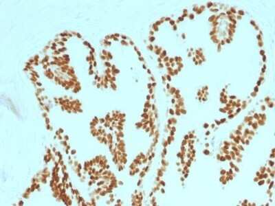 Immunohistochemistry-Paraffin: HNF-3 alpha/FoxA1 Antibody (FOXA1/1515) - Azide and BSA Free [NBP2-54415]