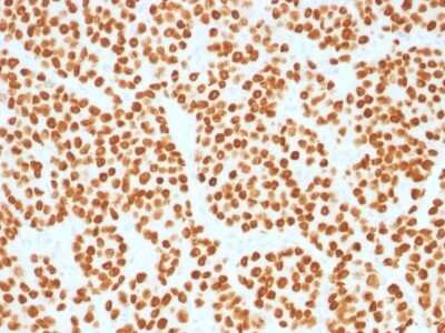Immunohistochemistry-Paraffin: HNF-3 alpha/FoxA1 Antibody (FOXA1/1515) [NBP2-53323]