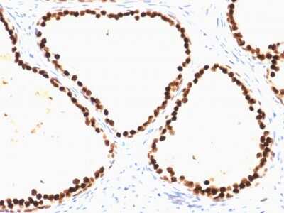 Immunohistochemistry-Paraffin: HNF-3 alpha/FoxA1 Antibody (FOXA1/1515) [NBP2-53323]