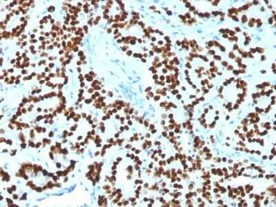 Immunohistochemistry-Paraffin: HNF-3 alpha/FoxA1 Antibody (FOXA1/1518) - Azide and BSA Free [NBP2-54414]