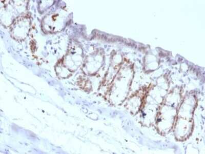 Immunohistochemistry-Paraffin: HNF-3 alpha/FoxA1 Antibody (FOXA1/1518) - Azide and BSA Free [NBP2-54414]