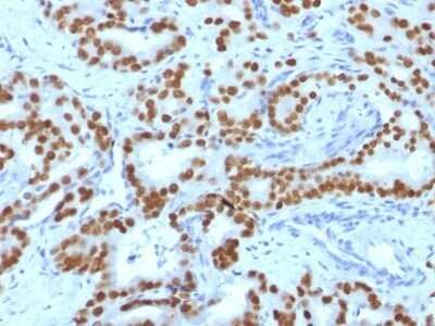 Immunohistochemistry-Paraffin: HNF-3 alpha/FoxA1 Antibody (FOXA1/1519) - Azide and BSA Free [NBP2-54413]