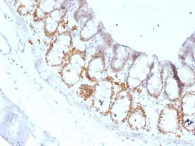 Immunohistochemistry-Paraffin: HNF-3 alpha/FoxA1 Antibody (FOXA1/1519) - Azide and BSA Free [NBP2-54413]