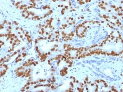 Immunohistochemistry-Paraffin: HNF-3 alpha/FoxA1 Antibody (FOXA1/1519) [NBP2-53331]