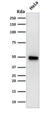 Western Blot: HNF-3 alpha/FoxA1 Antibody (FOXA1/1519) [NBP2-53331]