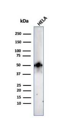 Western Blot: HNF-3 alpha/FoxA1 Antibody (FOXA1/2230R)Azide and BSA Free [NBP3-08921]