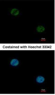 Immunocytochemistry/ Immunofluorescence: HNF-3 alpha/FoxA1 Antibody [NBP1-30877]