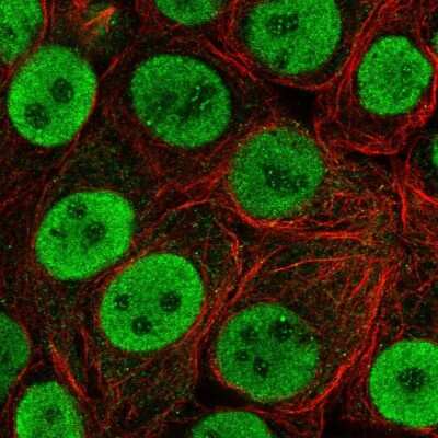 Immunocytochemistry/ Immunofluorescence: HNF-3 alpha/FoxA1 Antibody [NBP2-38628]