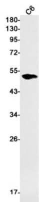 Western Blot: HNF-3 alpha/FoxA1 Antibody (S04-5A7) [NBP3-19637]