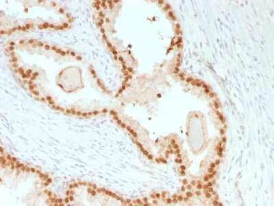 Immunohistochemistry-Paraffin: HNF-3 alpha/FoxA1 Antibody (rFOXA1/1515) [NBP3-07177]