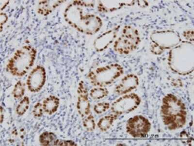 Immunohistochemistry-Paraffin: HNF-3 beta/FoxA2 Antibody (1C7) [H00003170-M10]