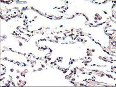 Immunohistochemistry-Paraffin: HNF-3 beta/FoxA2 Antibody (OTI3C10) [NBP2-02088]