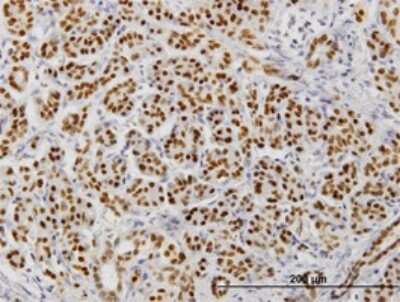 Immunohistochemistry-Paraffin: HNF-3 beta/FoxA2 Antibody (6C12) [H00003170-M12]