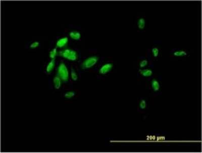 Immunocytochemistry/ Immunofluorescence: HNF-3 beta/FoxA2 Antibody (7E6) [H00003170-M01]