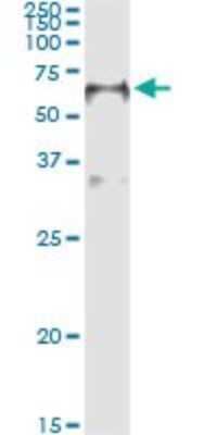 Immunoprecipitation: HNF-3 beta/FoxA2 Antibody (7E6) [H00003170-M01]