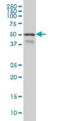 Western Blot: HNF-3 beta/FoxA2 Antibody (7E6) [H00003170-M01]