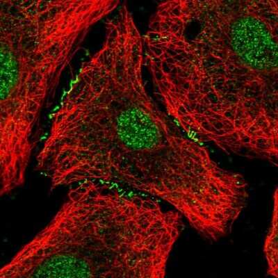 Immunocytochemistry/ Immunofluorescence: HNF-3 beta/FoxA2 Antibody [NBP2-57623]