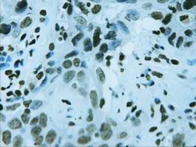 Immunohistochemistry: HNF-3 beta/FoxA2 Antibody (OTI3C10) - Azide and BSA Free [NBP2-70904]