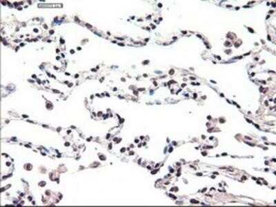 Immunohistochemistry: HNF-3 beta/FoxA2 Antibody (OTI3C10) - Azide and BSA Free [NBP2-70904]