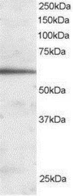 Western Blot: HNF-3 beta/FoxA2 Antibody [NB100-1263]