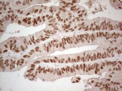 Immunohistochemistry: HNF-4 alpha/NR2A1 Antibody (OTI2H2) [NBP2-45989]
