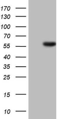 Western Blot: HNF-4 alpha/NR2A1 Antibody (OTI2H2) [NBP2-45989]