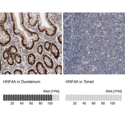 Immunohistochemistry-Paraffin: HNF-4 alpha/NR2A1 Antibody [NBP1-89679]