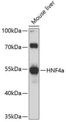 Western Blot: HNF-4 alpha/NR2A1 AntibodyBSA Free [NBP3-03208]