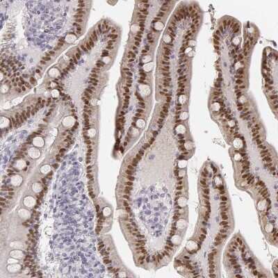 Immunohistochemistry-Paraffin: HNF-4 gamma/NR2A2 Antibody [NBP1-82531]