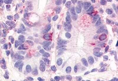 Immunohistochemistry-Paraffin: HNF-4 gamma/NR2A2 Antibody - BSA Free [NLS5162]